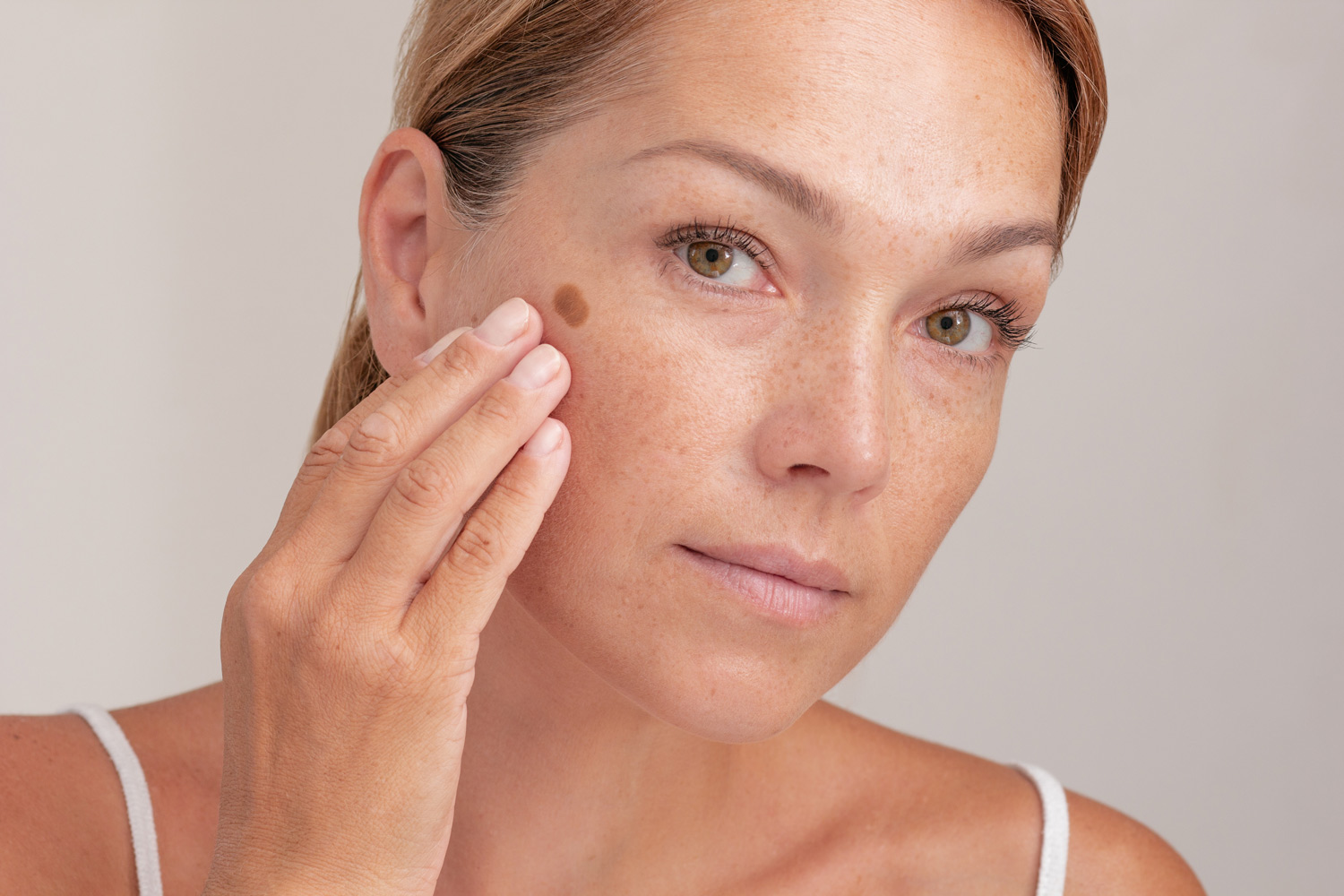 Close-up of a woman gently touching a brown spot on her cheek, highlighting hyperpigmentation on fair skin for a blog about brown spots on skin causes and treatments.